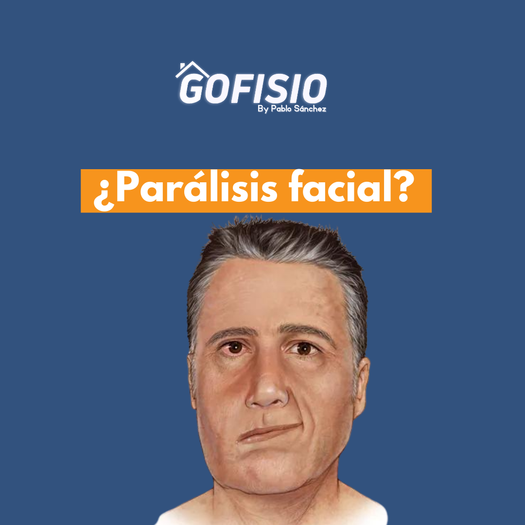 ¿Paralisis facial?